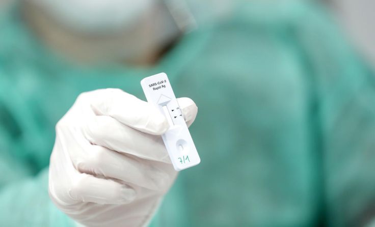 Massentestung mittels Antigen-Test (Foto: Volker Weihbold)