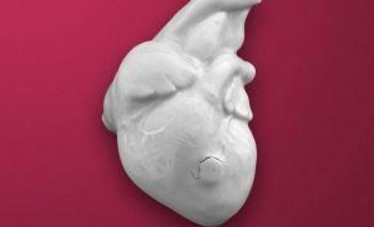Das Cover der neuen CD "Glass Bones" von Lausch.