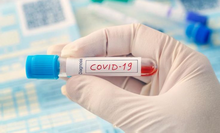 Ein Mitarbeiter wurde positiv auf COVID-19 getestet. Foto: diy13/Shutterstock.com