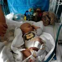 Zweite große Herzoperation für die kleine Paulina