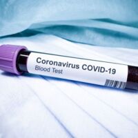 Erster bestätigter Corona-Patient im Bezirk Kirchdorf